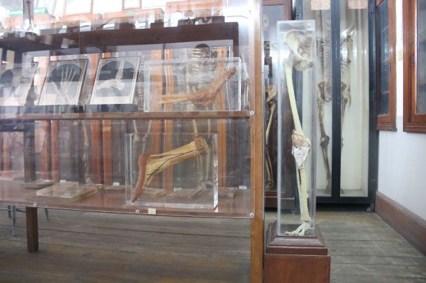 พิพิธภัณฑ์กายวิภาค-คองดอน - Image 6